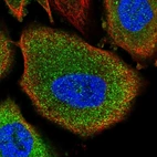 Immunofluorescent staining of human cell line PC-3 shows localization to cytosol.