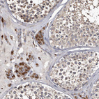 Immunohistochemical staining of human testis shows strong granular cytoplasmic positivity in Leydig cells.