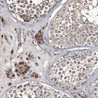 Immunohistochemical staining of human testis shows strong granular cytoplasmic positivity in Leydig cells.