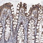 Immunohistochemical staining of human rectum shows moderate granular cytoplasmic positivity in glandular cells.