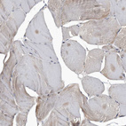 Immunohistochemical staining of human skeletal muscle shows only very weak positivity in striated muscle fibers as expected.