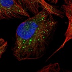 Immunofluorescent staining of human cell line U-2 OS shows localization to vesicles.