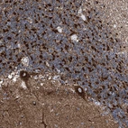Immunohistochemical staining of human cerebellum shows strong granular cytoplasmic positivity in Purkinje cells.