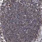 Immunohistochemical staining of human lymph node shows strong granular cytoplasmic positivity in non-germinal center cells.