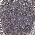 Immunohistochemical staining of human lymph node shows strong granular cytoplasmic positivity in non-germinal center cells.