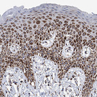 Immunohistochemical staining of human skin shows strong granular cytoplasmic positivity in squamous epithelial cells.