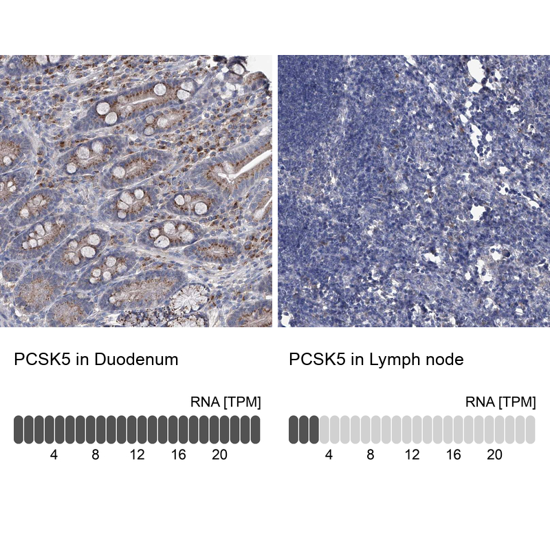 Anti-PCSK5 Antibody