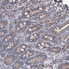 Immunohistochemical staining of human duodenum shows high expression.