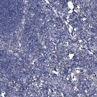 Immunohistochemical staining of human lymph node shows low expression as expected.