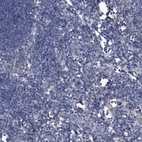 Immunohistochemical staining of human lymph node shows low expression as expected.