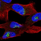 Immunofluorescent staining of human cell line RH-30 shows localization to the Golgi apparatus.