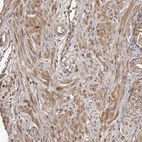 Immunohistochemical staining of human prostate shows moderate to strong cytoplasmic positivity in smooth muscle cells.