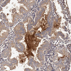 Anti-CTGF Antibody