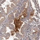 Immunohistochemical staining of human endometrium shows moderate to strong secreted positivity.