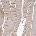 Immunohistochemical staining of human skeletal muscle shows weak to moderate cytoplasmic positivity in myocytes.