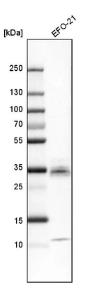 Western blot analysis in human cell line EFO-21.