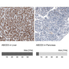 Anti-ABCD3 Antibody