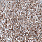 Anti-ABCD3 Antibody