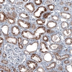 Immunohistochemical staining of human kidney shows moderate granular cytoplasmic positivity in cells in tubules.