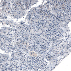 Anti-ABCD3 Antibody