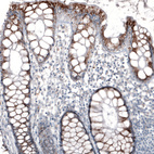 Anti-ABCD3 Antibody