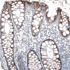 Immunohistochemical staining of human rectum shows moderate granular cytoplasmic positivity in glandular cells.