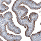 Immunohistochemical staining of human fallopian tube shows moderate granular cytoplasmic positivity in glandular cells.