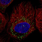 Immunofluorescence staining in A431 cell line with Anti-ABCD3 monoclonal antibody, showing specific staining of peroxisomes in green. Microtubule- and nuclear probes are visualized in red and blue respectively (where available).