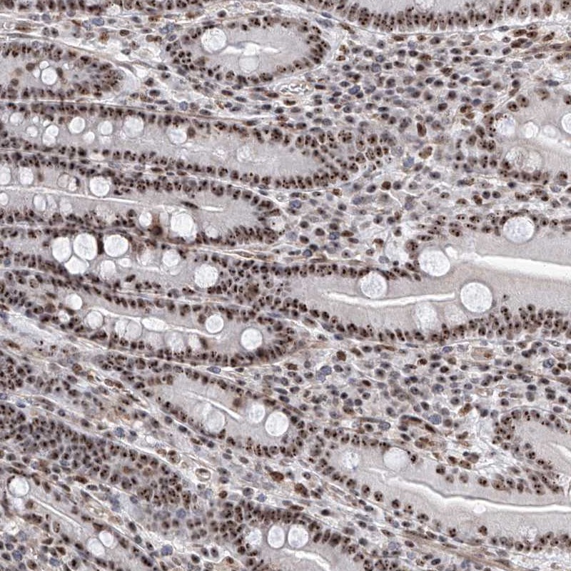 Anti-PRUNE2 Antibody