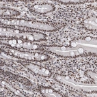 Anti-PRUNE2 Antibody