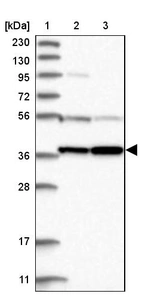 Lane 1: Marker [kDa] 230, 130, 95, 72, 56, 36, 28, 17, 11_br/_Lane 2: Human cell line RT-4_br/_Lane 3: Human cell line U-251MG sp