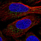 Immunofluorescence staining in U2OS cell line with Anti-ABCD3 monoclonal antibody, showing specific staining of peroxisomes in green. Microtubule- and nuclear probes are visualized in red and blue respectively (where available).