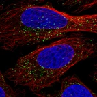 Immunofluorescence staining in U2OS cell line with Anti-ABCD3 monoclonal antibody, showing specific staining of peroxisomes in green. Microtubule- and nuclear probes are visualized in red and blue respectively (where available).