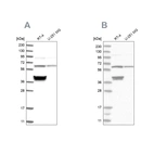 Western blot analysis using Anti-TCP1 antibody HPA031082 (A) shows similar pattern to independent antibody HPA027337 (B).