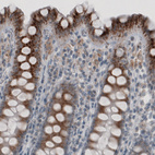 Anti-ACAA1 Antibody