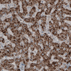 Anti-ACAA1 Antibody