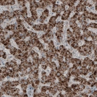 Immunohistochemical staining of human liver shows strong granular cytoplasmic positivity in hepatocytes.