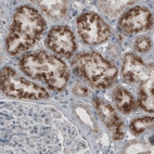 Immunohistochemical staining of human kidney shows granular cytoplasmic immunoreactivity in renal tubules.