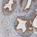 Anti-ACAA1 Antibody