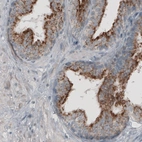 Immunohistochemical staining of human prostate shows strong granular cytoplasmic positivity in glandular cells.