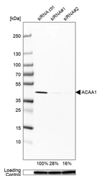 Western blot analysis in U-251MG cells transfected with control siRNA, target specific siRNA probe #1 and #2, using Anti-ACAA1 antibody. Remaining relative intensity is presented. Loading control: Anti-PPIB.
