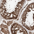 Immunohistochemical staining of human testis shows strong cytoplasmic positivity in cells in seminiferous ducts and leydig cells.