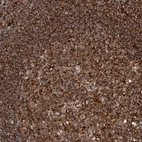 Immunohistochemical staining of human lymph node shows strong cytoplasmic positivity in germinal center cells and non germinal center cells.