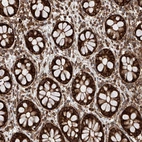 Immunohistochemical staining of human rectum shows strong cytoplasmic positivity in glandular cells.