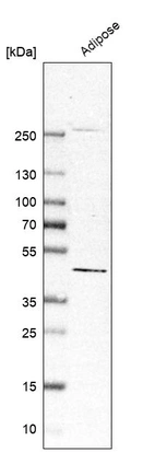 Western blot analysis in human adipose tissue tissue.