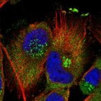 Immunofluorescent staining of human cell line U-251 MG shows localization to cytosol & the Golgi apparatus.