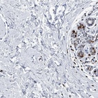 Immunohistochemical staining of human breast shows high expression.
