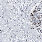 Immunohistochemical staining of human breast shows high expression.