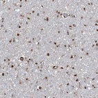 Immunohistochemical staining of human cerebral cortex shows low expression as expected.