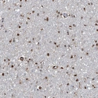 Immunohistochemical staining of human cerebral cortex shows low expression as expected.